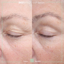 Lade das Bild in den Galerie-Viewer, EGF SERUM SET 15ml+5ml

