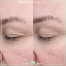 Lade das Bild in den Galerie-Viewer, EGF Eye Serum
