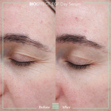 Lade das Bild in den Galerie-Viewer, EGF DAY SERUM
